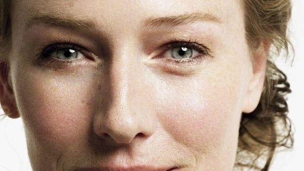 bags under eyes