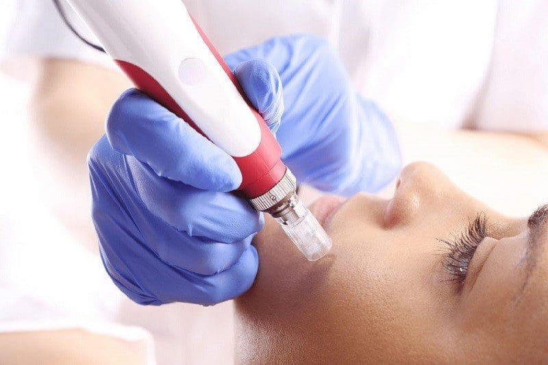 Mesotherapy Skin