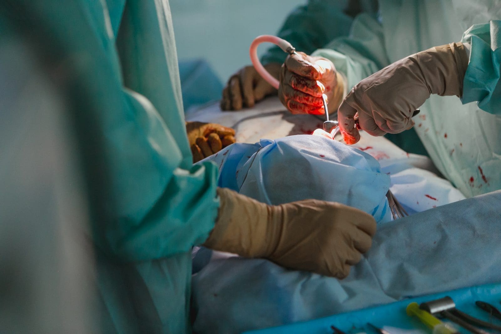 Surgery Surgical Team