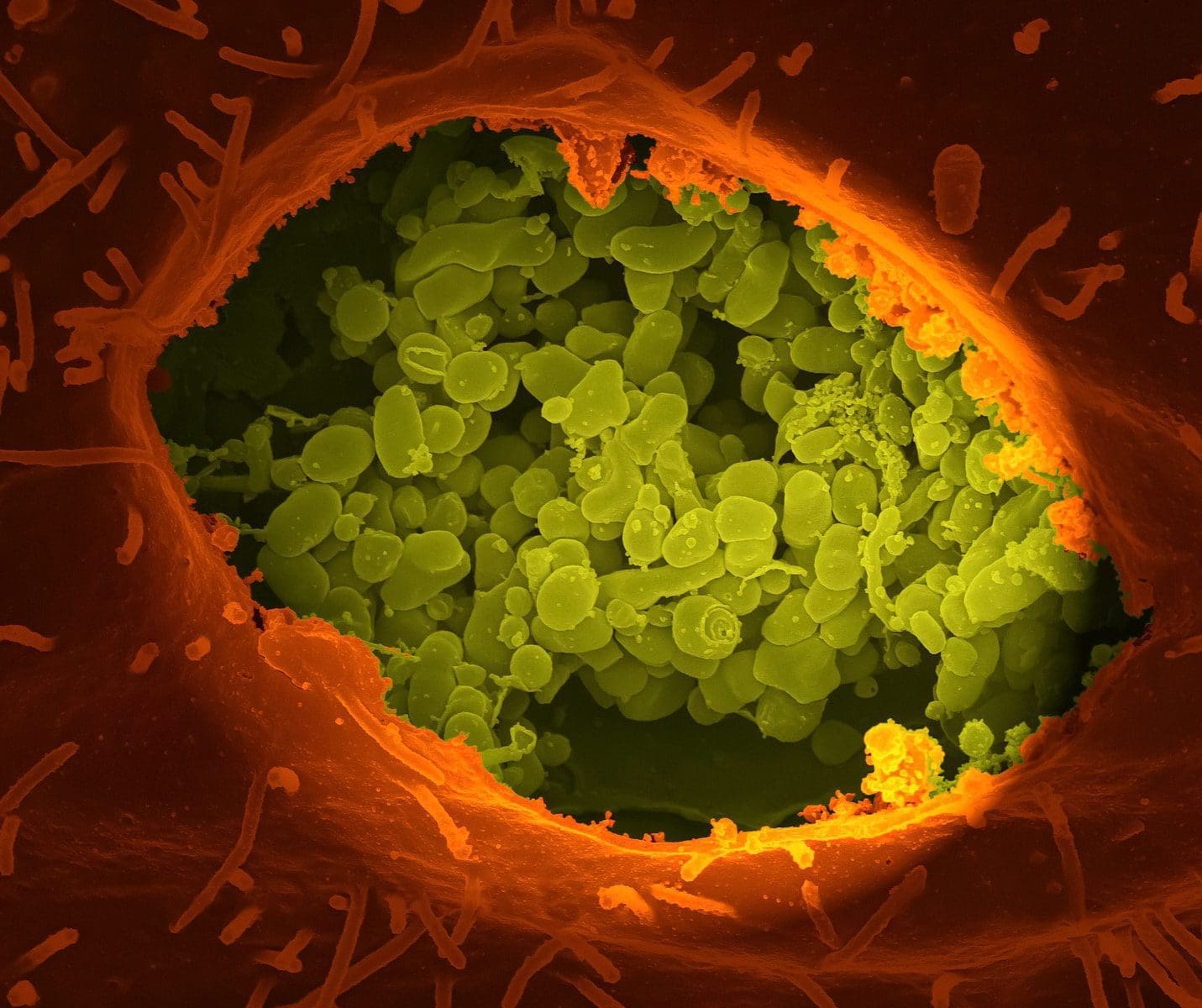 microbiology microorganisms