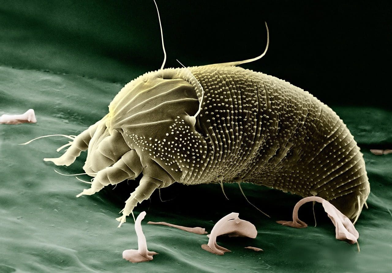 electron microscope
