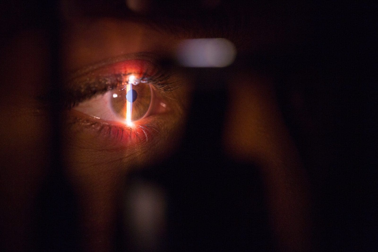 eye surgery