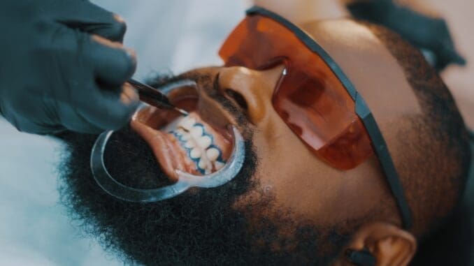 a man getting his teeth brushed by a dentist cosmetic dentistry